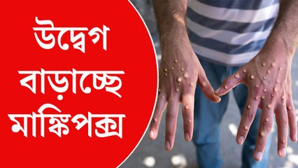 Monkeypox: মাঙ্কিপক্স নিয়ে বাড়ছে আতঙ্ক, উদ্বেগে চিকিৎসকেরা