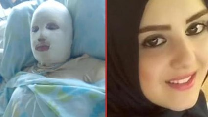 Kürtaj olmayı reddeden hamile eşini gaz tüpüyle yaktı