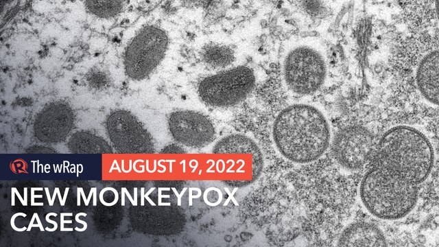 Philippines detects 2 new cases of monkeypox