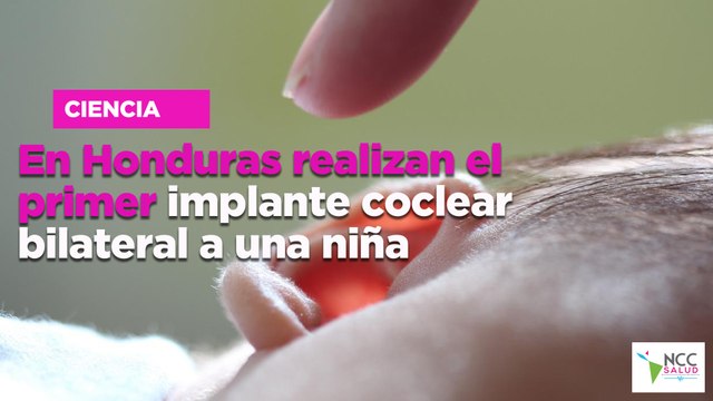 En Honduras realizan el primer implante coclear bilateral a una niña