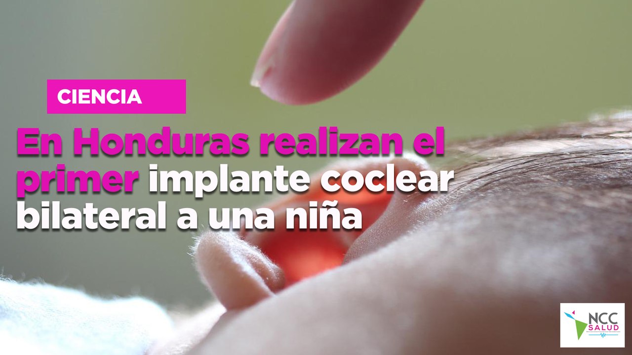 En Honduras realizan el primer implante coclear bilateral a una niña