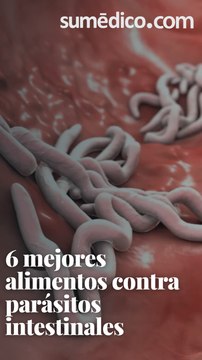 6 mejores alimentos contra parásitos intestinales