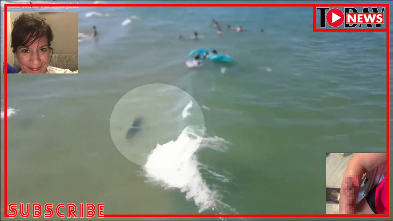 Beach Tragedy | Shark bites 2 swimmer on Myrtle Beach in South Carolina