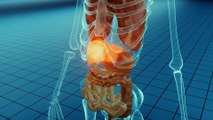 Warning Signs of Cirrhosis (End-Stage Liver Disease) - Dr. Berg