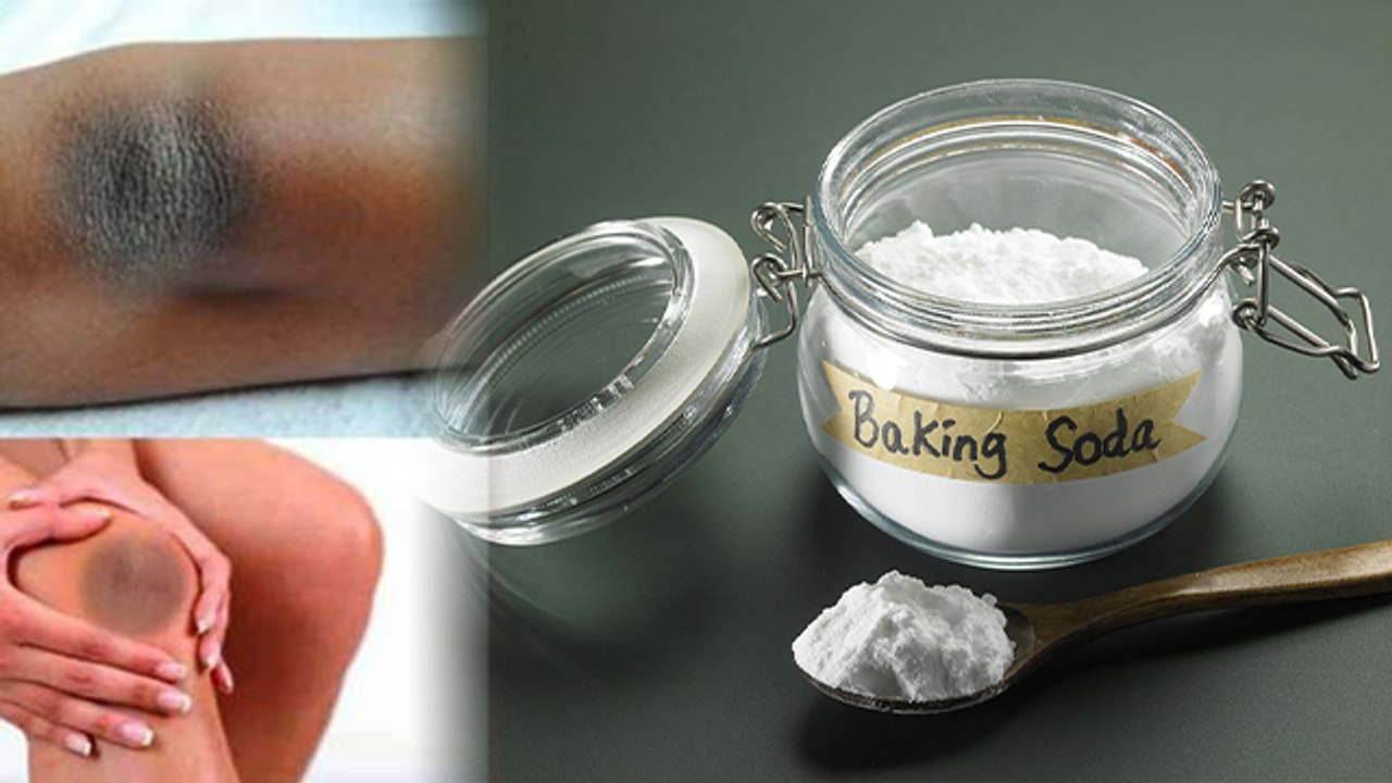 Baking Soda से क्या सच में दूर होता है कालापन ।...
