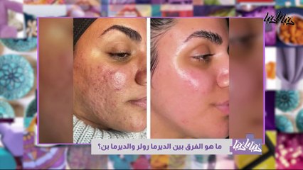 كيف أزيد معدل حرق الدهون في الجسم ؟