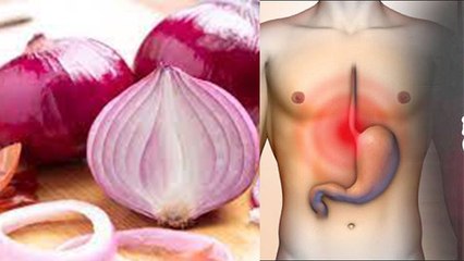 प्याज खाने के नुकसान चेहरे से लेकर पेट पर करता है बुरा असर । Boldsky *Health