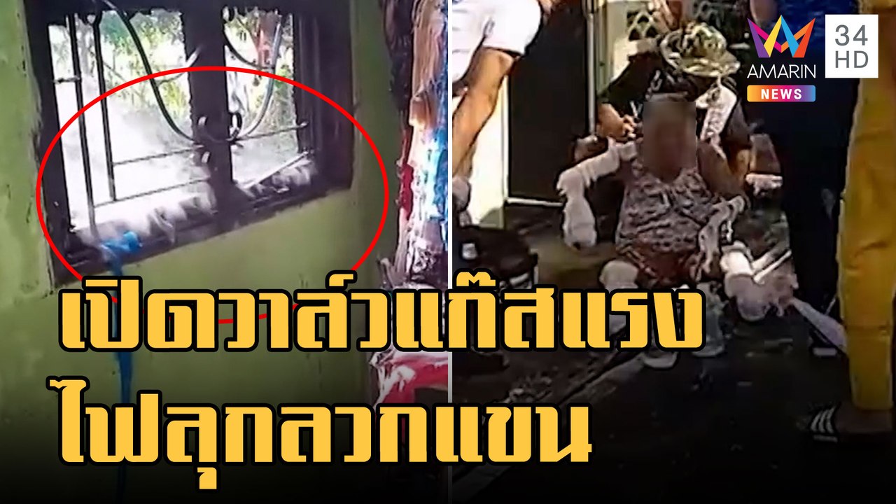 ยายเปิดวาล์วแก๊สแรงเกินไฟลุกลวกแขน กลิ้งถังออกห...