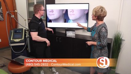 Contour Medical: One treatment that can help change the way your skin looks