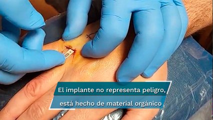 Hombre se implanta llave de Tesla en la mano para no perderla