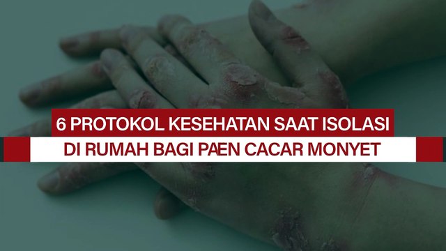 Terpapar Cacar Monyet, Ini 6 Anjuran WHO Saat Isolasi Mandiri di Rumah