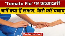 Tomato Flu से सावधान, Modi Govt. ने टोमैटो फ्लू  को लेकर जारी की एडवायजरी | वनइंडिया हिंदी *News