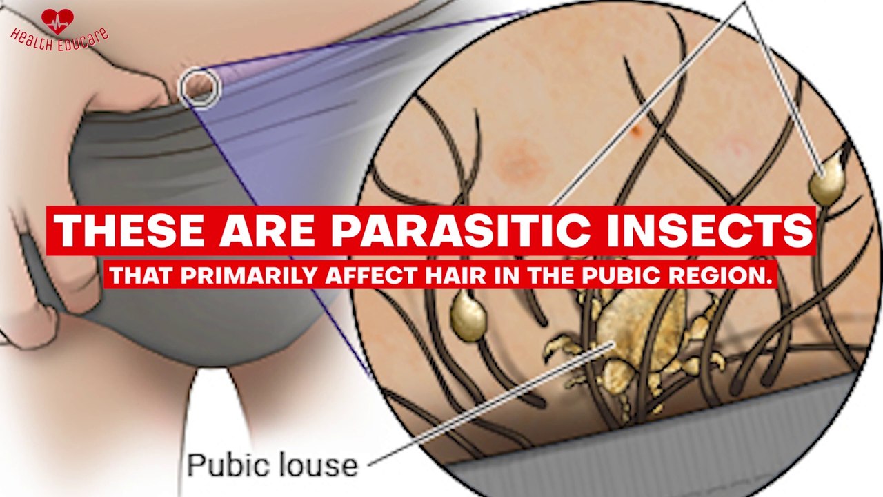 Reason why your Pubic Hair might turn Gray (White Pubic Hair)