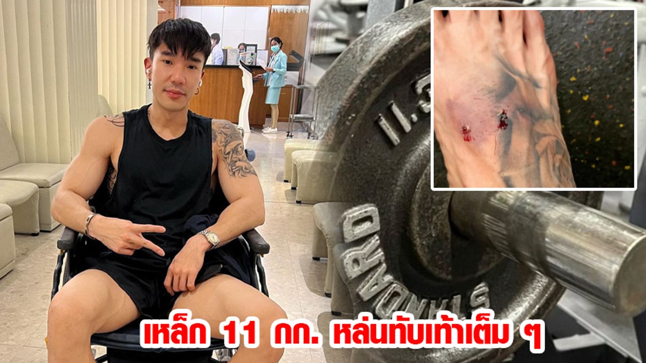 บอส ณัชพงศ์พล เตือนคนออกกำลังกาย หลังถูกเหล็ก 1...