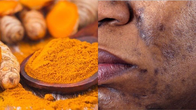 चेहरे पर हल्दी लगाने से क्या होता है । चेहरे पर हल्दी लगाने के है जबरदस्त फायदे । Boldsky *Health