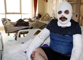 Son dakika haber: OTOGAZ BAKIM DÜKKANINDA PATLAMA OLDU, 'CEHENNEMİ YAŞADIK' DEDİ