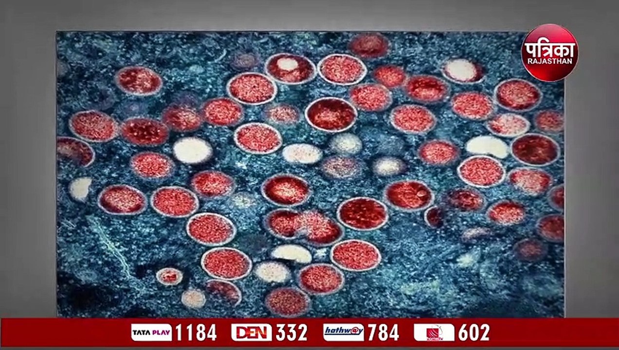 Monkeypox: एक साथ मंकीपॉक्स, कोरोना वायरस और एच...