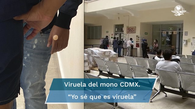 “No le conté a nadie que puedo tener viruela del mono”