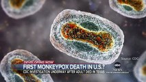 Texas reports 1st monkeypox death in US l WNT