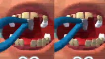 Welcome to my channel suresh asmr animation   asmr animation teeth treatment #asmr #gookasmr #asmranimationoperationvideo #asmrsatisfyingvideo