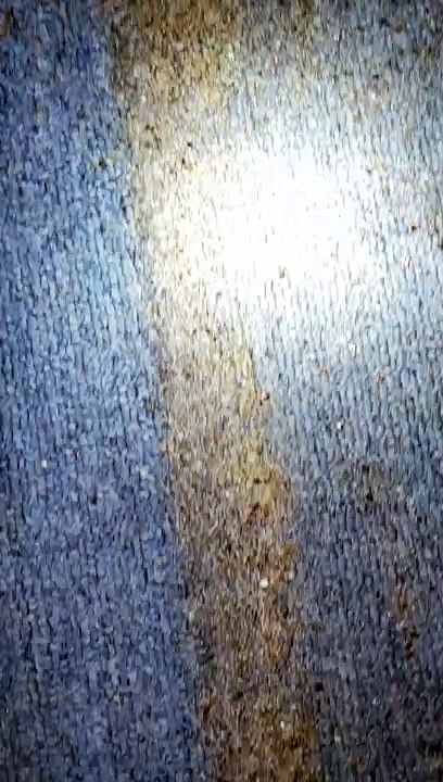 Really Bad Bedbug Infestation