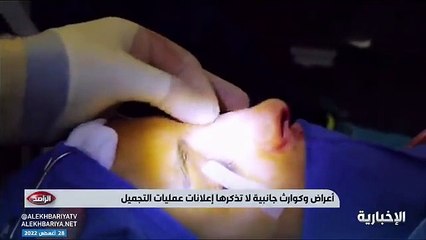 Tải video: فيديو بعد هوس المشاهير بالعمليات - استشاري جراحة التجميل والترميم د. معاذ حكمي عمليات التجميل قد تشوه.. وأضرار بعضها أكثر من منافعها - - الراصد