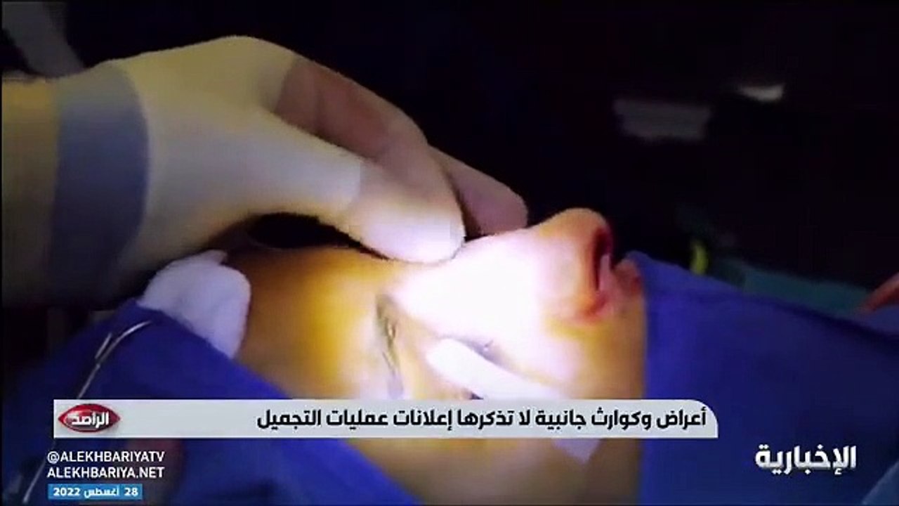 فيديو بعد هوس المشاهير بالعمليات - استشاري جراحة التجميل والترميم د. معاذ حكمي عمليات التجميل قد تشوه.. وأضرار بعضها أكثر من منافعها - - الراصد