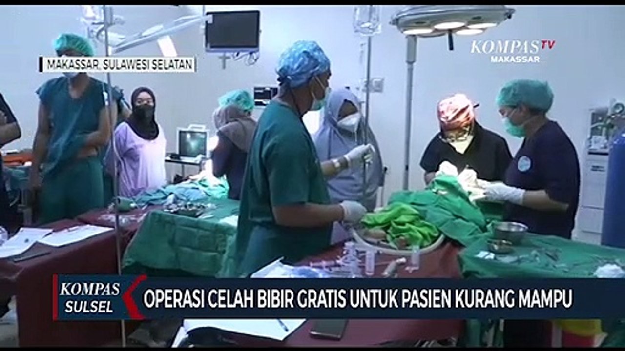 24 Pasien Kurang Mampu Jalani Operasi Celah Bibir Gratis