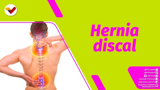 Buena Vibra | Hernia discal: ¿Cómo podemos tratar esta enfermedad?