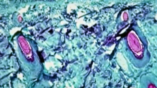 Breves Noticias 48 McAllen 1 minuto