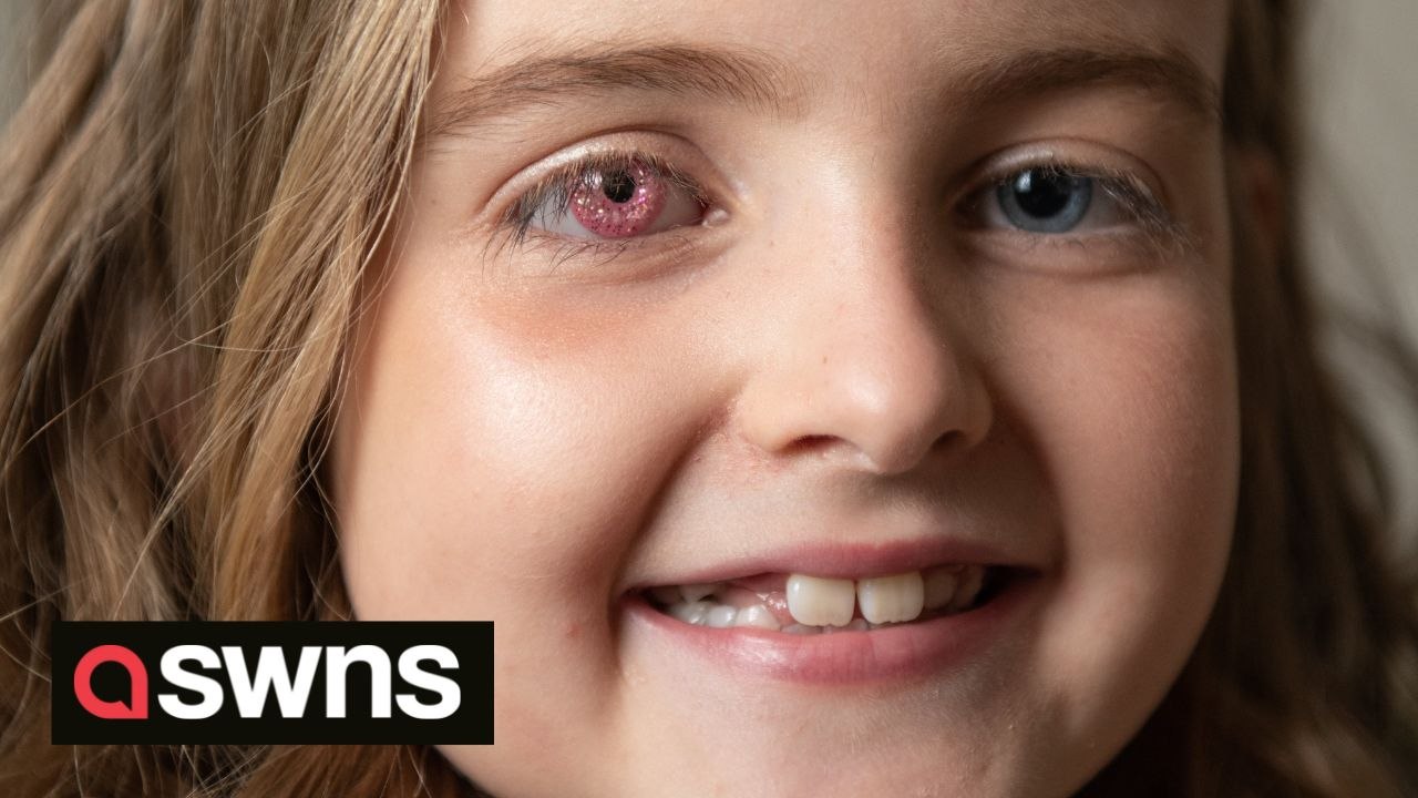 8-year-old who had eye removed due to cancer replaces it with PINK SPARKLY PROSTHETIC