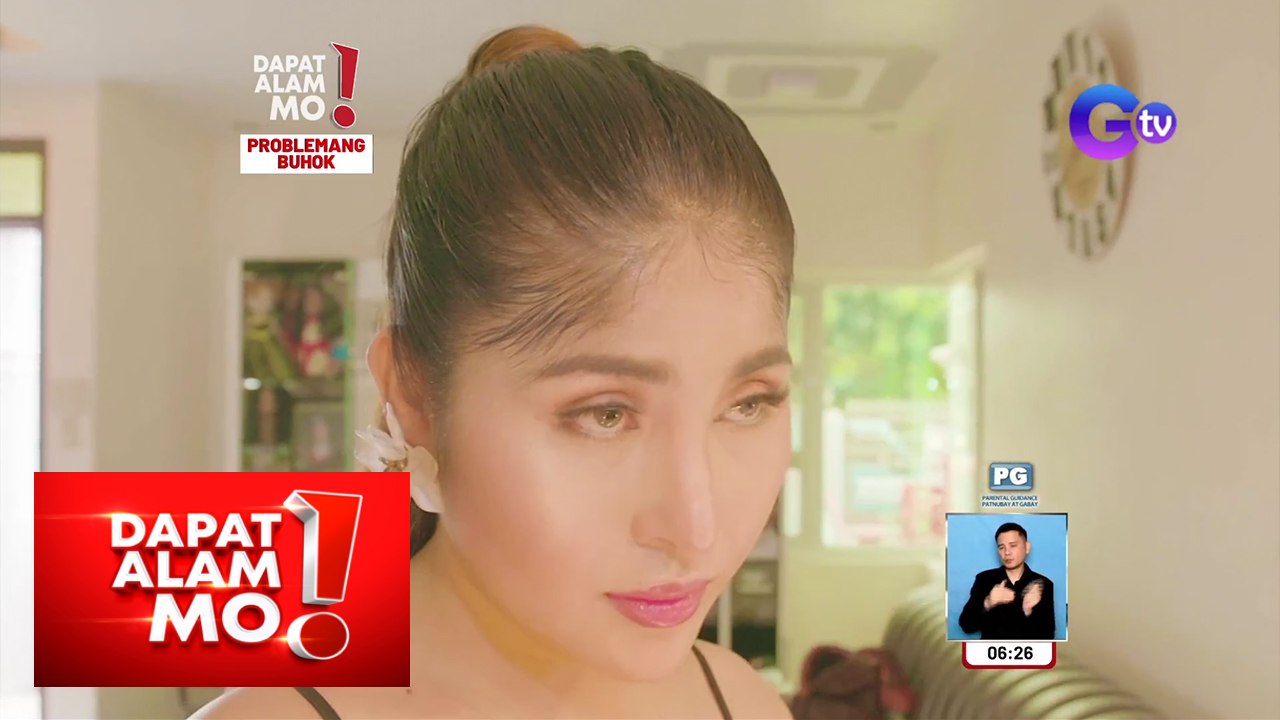Noo ng isang babae, tinubuan ng buhok dahil sa ginamit na produktong may minoxidil?! | Dapat Alam Mo!