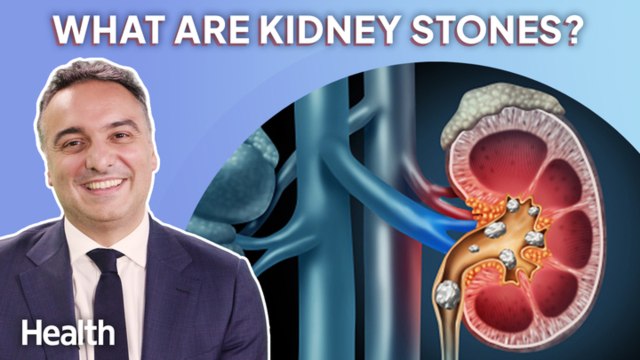 Urologist Answers YOUR Questions About Kidney Stones | Ask An Expert