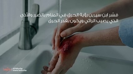 رؤية الحرق في المنام وتفسير حلم الاحتراق