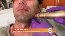 Contour Medical offers a treatment that can help with many different skin issues