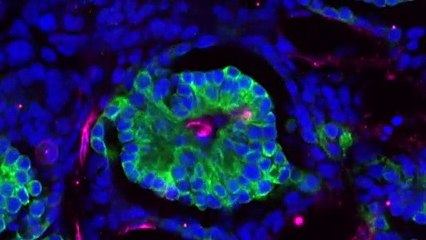 Drug to treat kidney disease will deliver relief to remote NT communities