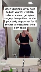 Mujer dará a luz por segunda ocasión en solo 14 semanas: le sacarán el bebé y se lo volverán a meter