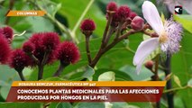 Conocemos plantas medicinales para las afecciones producidas por hongos en la piel