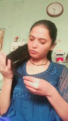 Hilarious Bird Legs Comedy 😂