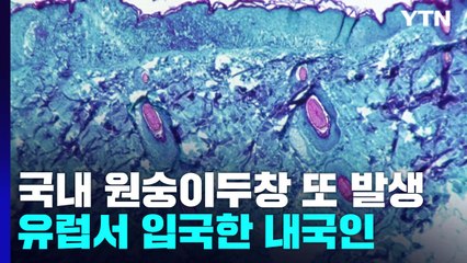 원숭이두창 국내 2번째 환자 확인...유럽서 입국한 내국인 / YTN