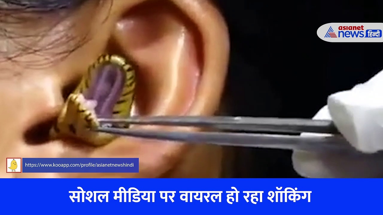 बिल की जगह लड़की के कान में घुसा सांप, ऐसी हुई हालत... दिल दहला देने वाला Video  