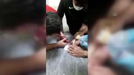 Son dakika haber: Bir kişinin parmağında sıkışan yüzüğü itfaiyeciler çıkardı