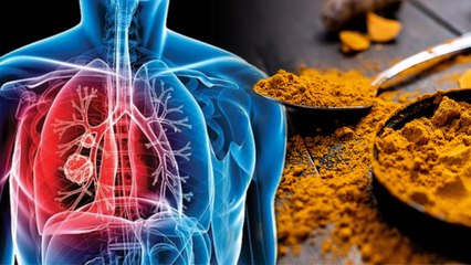 टीबी में हल्दी के इस्तमाल से मिलेगी राहत | TB के इलाज में फायदेमंद है हल्दी | Boldsky *health