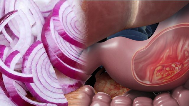 कच्चा प्याज खाने के नुकसान | Kacha Pyaz Khane Ke Nuksan | Boldsky *Health