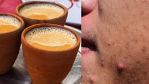 चाय पीने से चेहरे पर होते है गंभीर नुकसान, Chai Pine se Face per hote hai Nuksan | Boldsky *Health