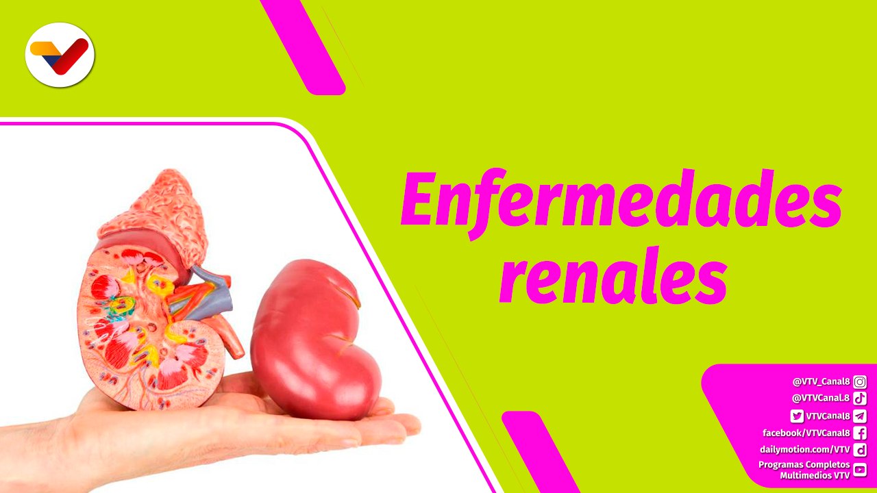 Buena Vibra | Lo que debes saber sobre las enfermedades renales hereditarias