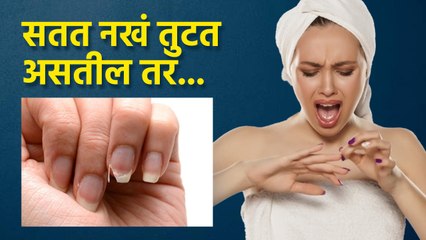 तुटणाऱ्या नखांसाठी वापरा या सोप्या टिप्स | Nail Care Tips Every One Should Know | Fix Broken Nail