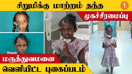 அறுவை சிகிச்சை முடிந்து வீடு திரும்பும் சிறுமி டானியா