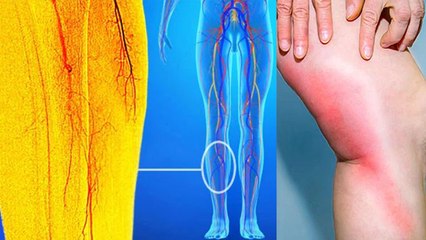 नसों में जकड़न क्यों होती है | नसों में जकड़न होने का कारण | Boldsky*Health