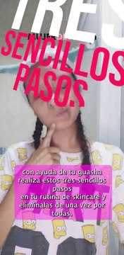 Trucos Líneas De Expresión